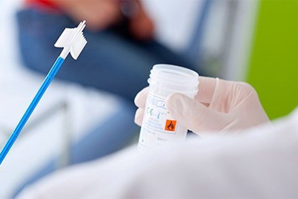 آزمایش محرمانه HPV